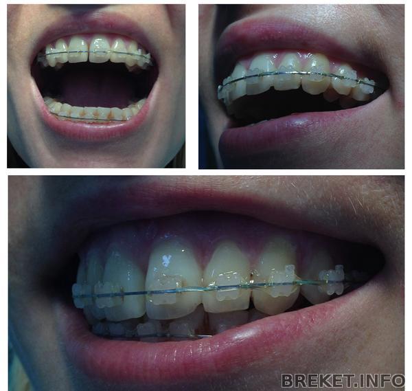 za_2_mes.do_snyatiya_.jpg za_2_mes.do_snyatiya_.jpg