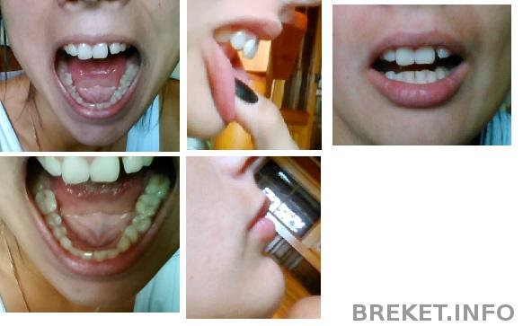 dsc_0176.jpg dsc_0176.jpg