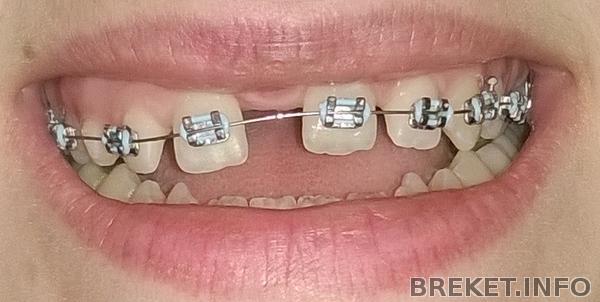 первый день