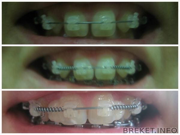 2 месяца - 3 месяца - 4 месяца