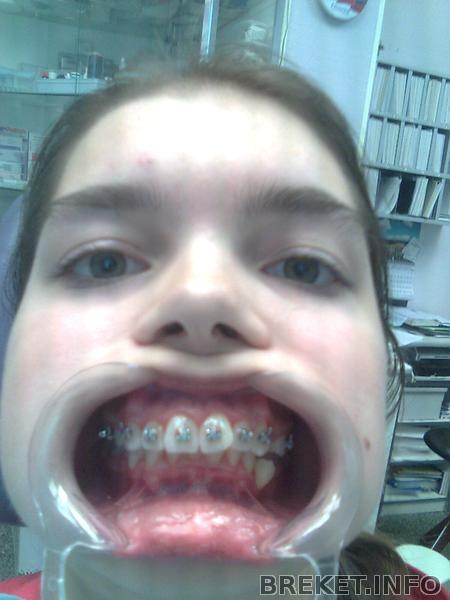 наклеили замочки